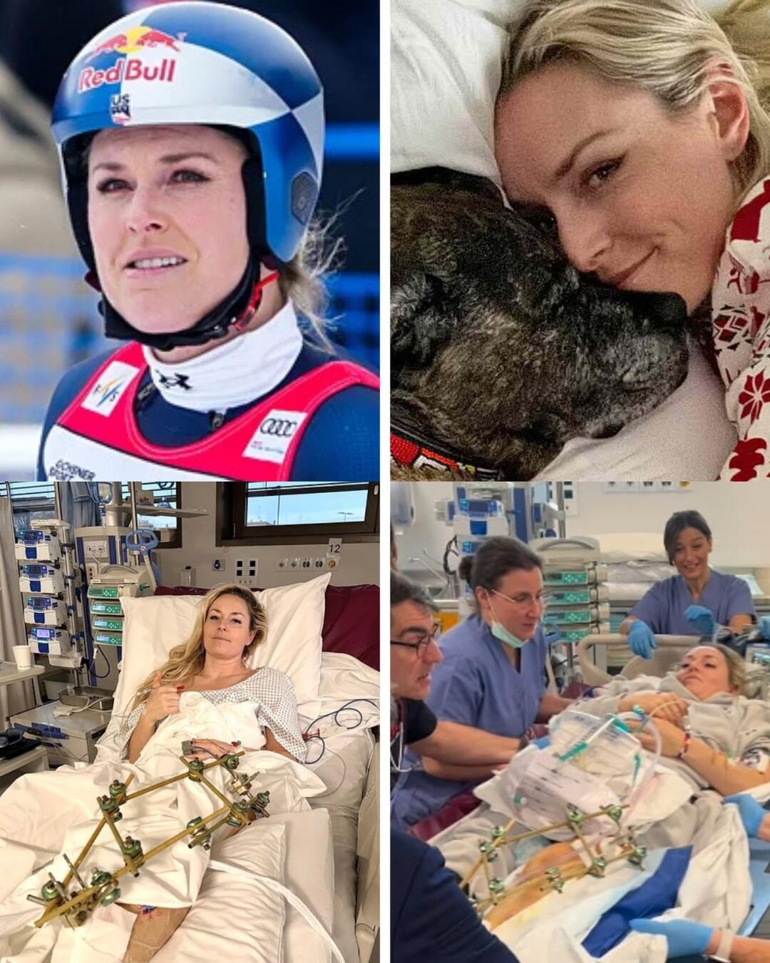 SHOCKING NEWS: Doctors reveal the results of Lindsey Vonn’s 6-hour surgery after the Olympic accident; she will never be able to…